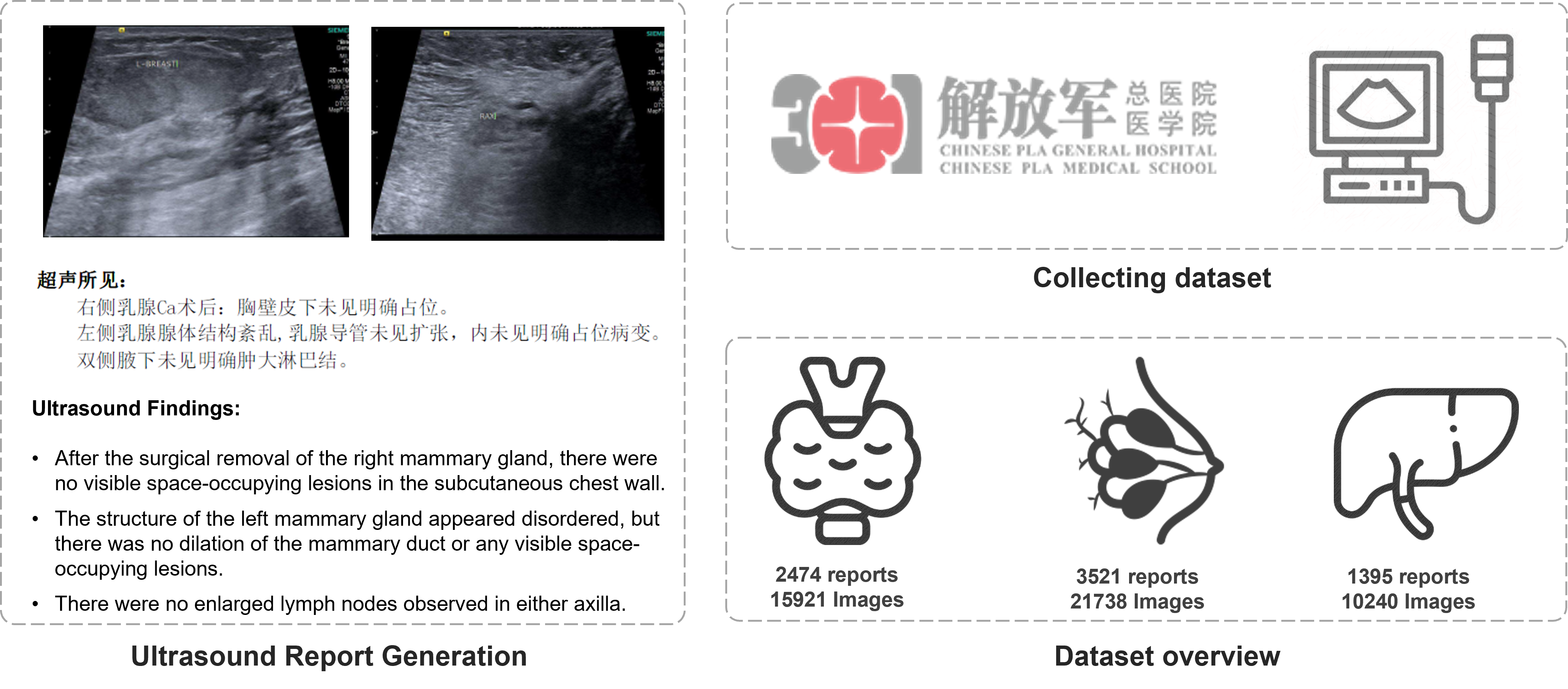 Dataset compression scale