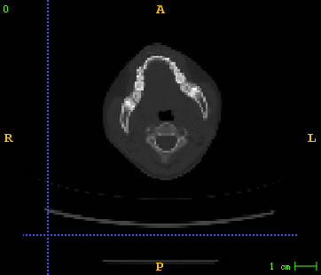 Reconstruct 3D CT from X-rays